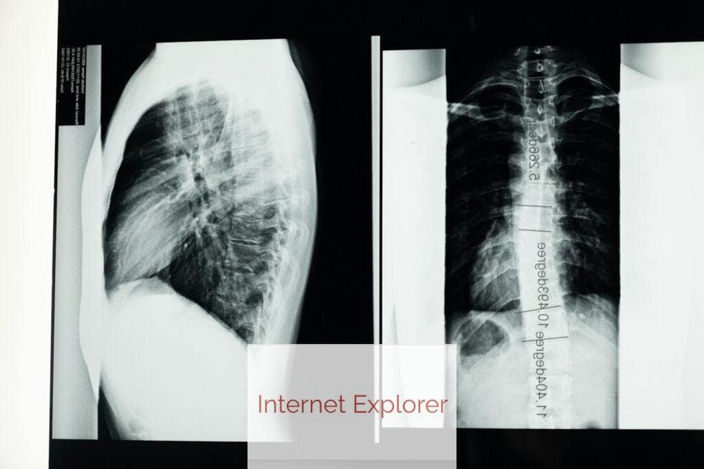 Beneficios fajas lumbares en personas mayores